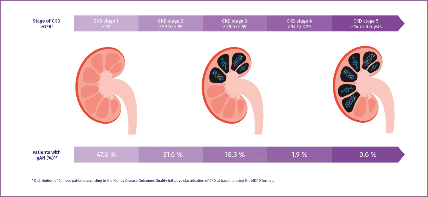 Kidney Disease Classification